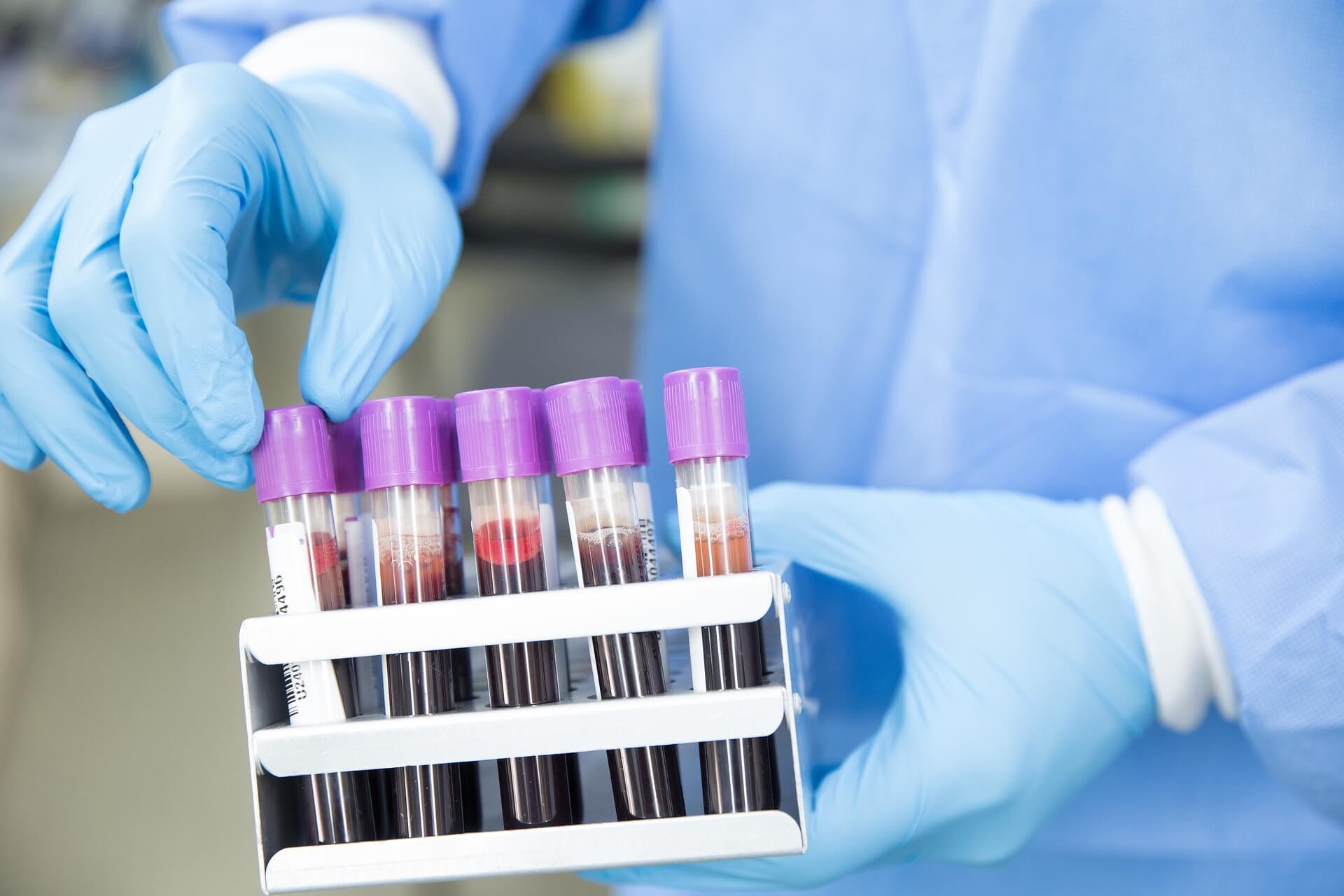 Ruce laboranta drží stojánek se skumavkami naplněnými krví