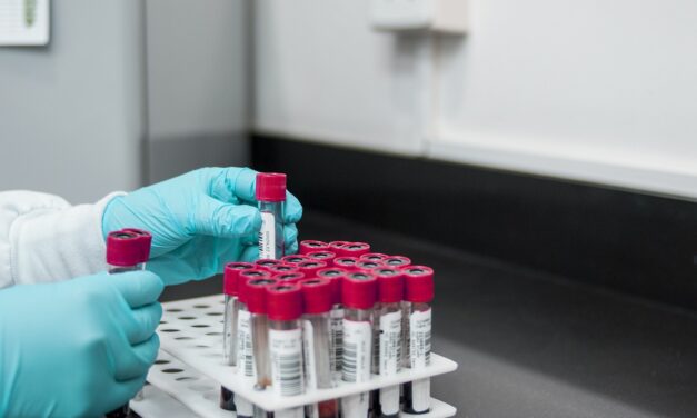 Eozinofilní zánět jako ukazatel účinnosti alergenové imunoterapie